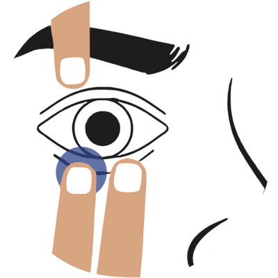 Eyelid Positioning