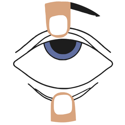 Eyelid Position