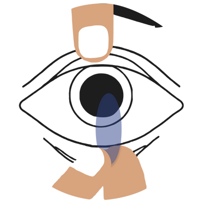 Lens Removal